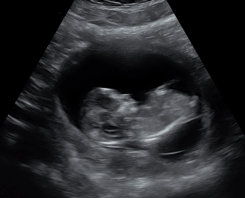 baby01