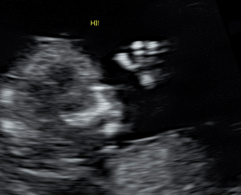 baby02