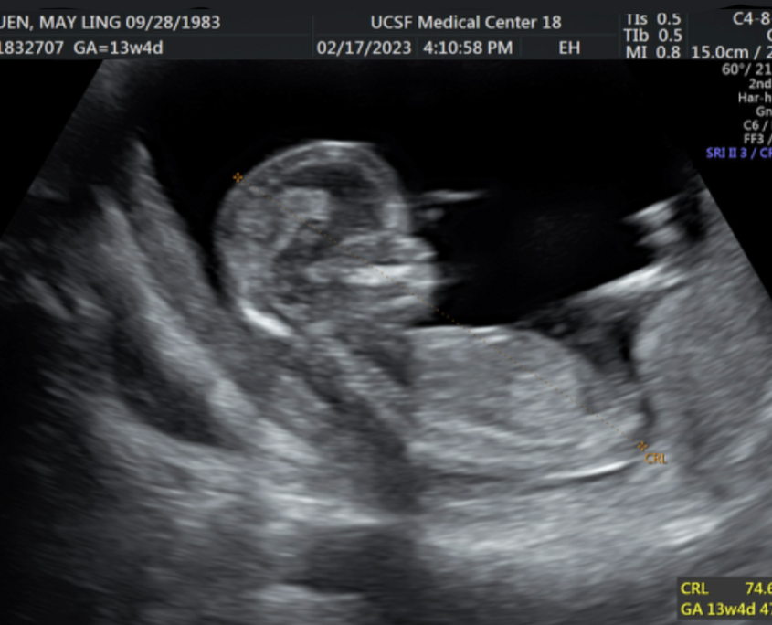 baby03
